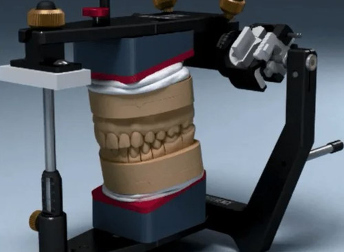 Функциональная диагностика в артикуляторе.jpg