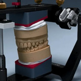 Функциональная диагностика в артикуляторе