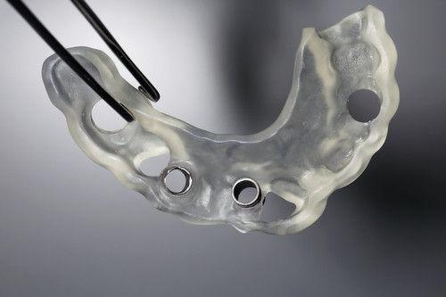 Dental implant template for two printed on 3D printer.jpg