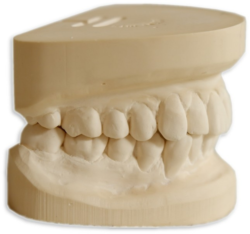 Исследование диагностических моделей челюстей.png