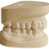 Исследование диагностических моделей челюстей