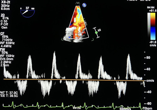 G7apazuWUAA OK0?format=jpg.jpg