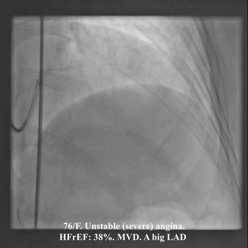 eu4f SL8e2KDJAx7.jpg