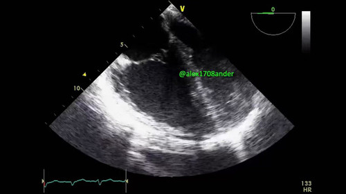 j8IjEco6 2Nq7mLP.jpg