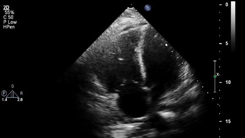 eGk62I tR32gFrcl.jpg