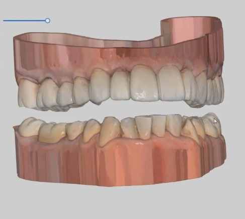 Внутриротовое 3D сканирование зубов в Москве.jpg