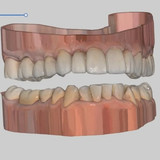 Внутриротовое 3D сканирование зубов в Москве