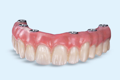 Установить постоянный акриловый протез «Всё на 4» на имплантах Osstem в Москве.jpg