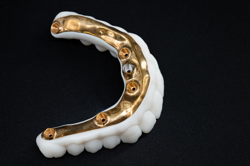 Фрезерованная балка с зубами Candulor на 4 имплантах.jpg