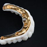 Фрезерованная балка с зубами Candulor на 4 имплантах