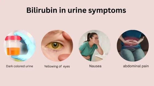 Bilirubin In Urine Symptoms.png