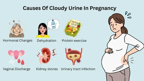 Causes Of Cloudy Urine In Pregnancy.png