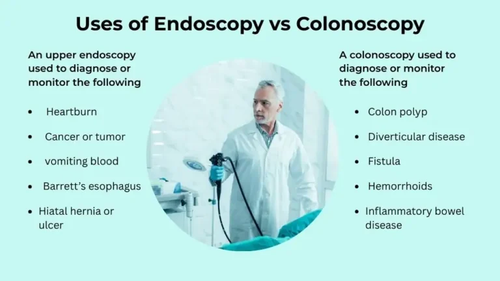 Endoscopy vs Colonoscopy Uses.png