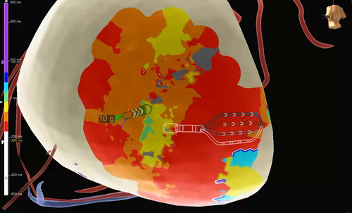 L2lD9dsoce MS7p6.jpg