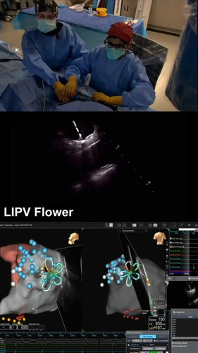xhlQ3LUFb4jpp4GF.jpg