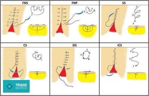 Untitled design (1).jpg