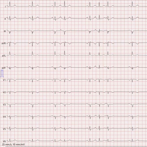 1zfBjLA6PV9QB WO.jpg