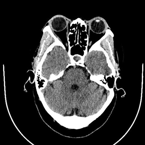 G zOehAboAAQMWO?format=jpg.jpg