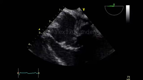 3pZaVdh7zO7I 7MG.jpg