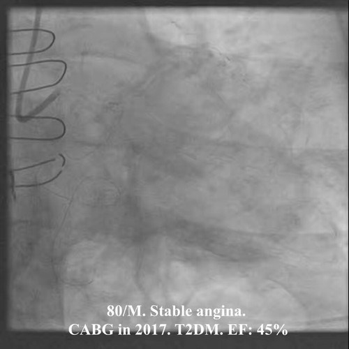 6I5A2I6WFqApwxy .jpg