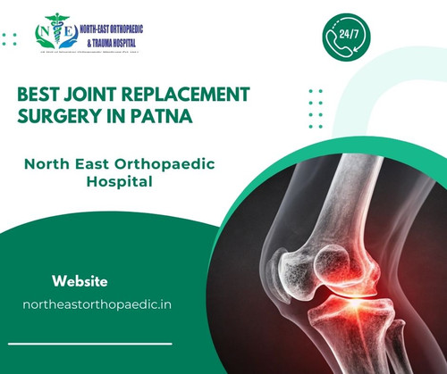Best joint replacement surgery in patna: North East Orthopaedic Hospital.jpg