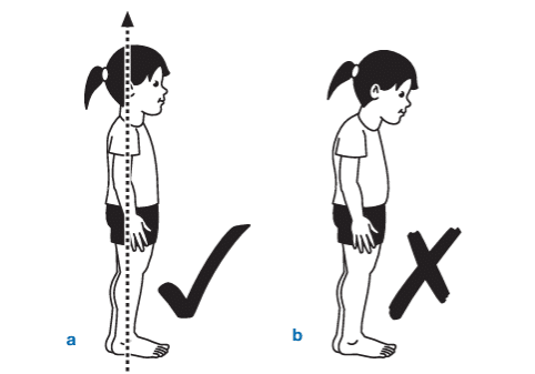 postura incorecta la copii.png