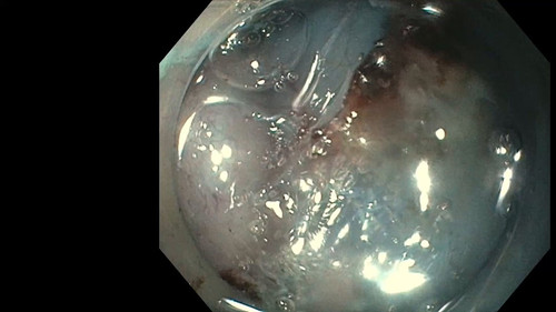 kehKhKgy9P CVAiq.jpg