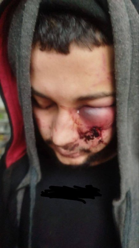 صورة أحد الشبان، حيث أطلق جيش الاحتلال سراح ثلاثة شبان على مدخل بلدة ديراستيا، وتبين أن الشبان من مدينة طولكرم، وقد تعرضوا للاعتداء بالضرب المبرح من ق...