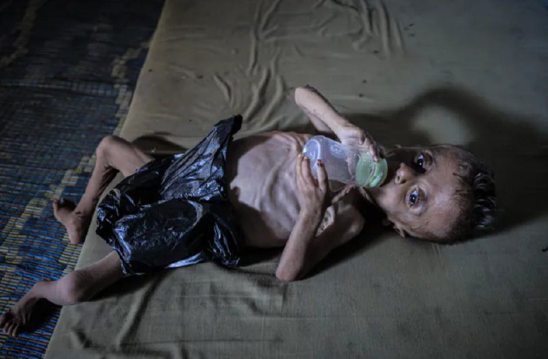 مدير عام وزارة الصحة في غزة، منير البرش، أشار إلى ارتفاع كبير في حالات الإجهاض مقابل انخفاض حاد في عدد المواليد بنسبة 40% مقارنة بالعام السابق، حيث تر...