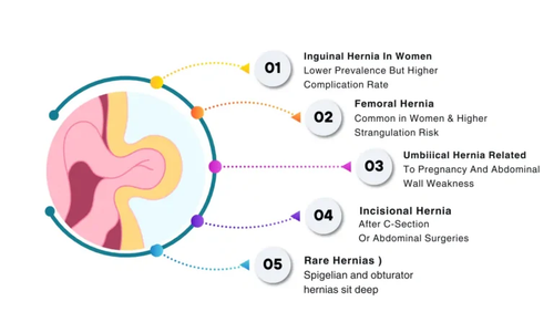 Types Of Hernia In Females.png