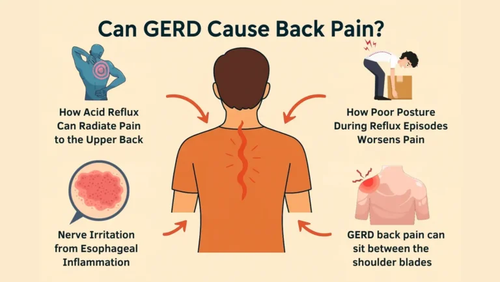 Can GERD Cause Back Pain?.png