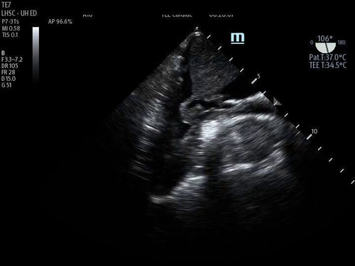 rcHK gMOj7cbum11.jpg