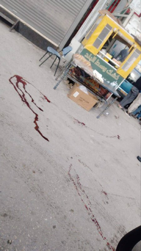 مجهولون يستقلون سيارة مسرعة ويطلقون النار على مواطن في بلدة ترقوميا غرب الخليل، مما أدى إلى إصابته في قدمه، وتم نقله إلى العيادة بالبلدة لتلقي العلاج....