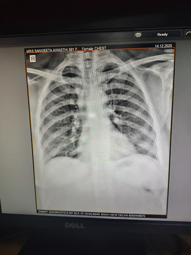 IMG 20251214 175400247 HDR.jpg