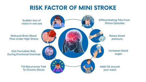 Can Stress Trigger A Mini Stroke.png