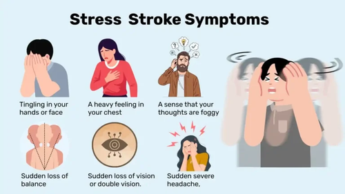 Stress-Induced Stroke Symptoms.png