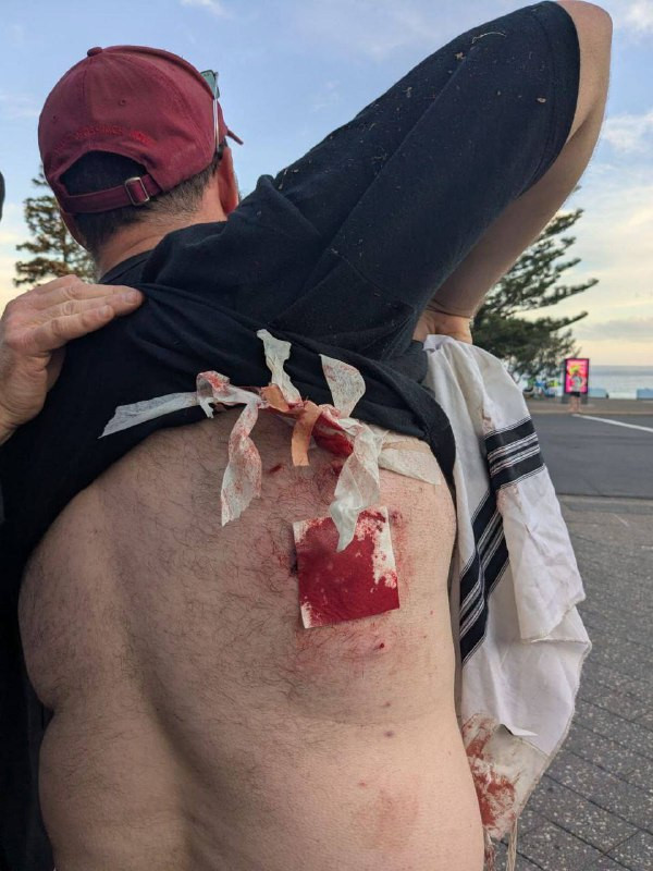 من عملية إطلاق النار الكبيره على حوالي 2000 اسرائيلي في احتفال عيد الانوار اليهودي حانوكاه في سدني باستراليا، حتى اللحظه 20 قتيل و100 جريح....