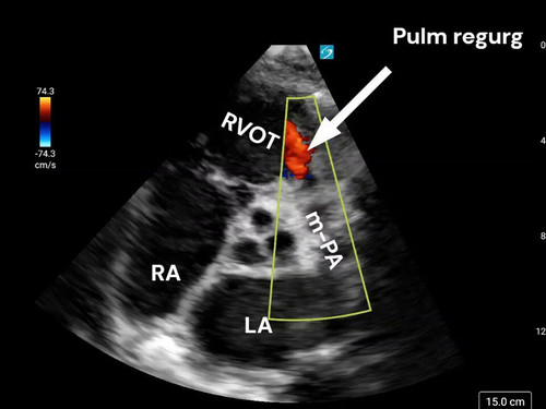 Hu8cg YAvcnmpqcG.jpg