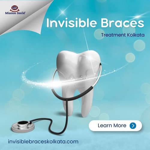 Hassle-Free Alignment Starts With Affordable Invisible Braces Treatment Kolkata.jpg