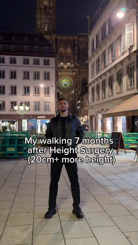 X1LKygyfEDGhyIVm.jpg