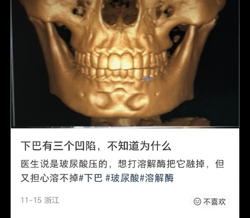 1000023328.jpg