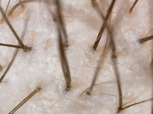 WIN 20260206 16 16 00 Pro