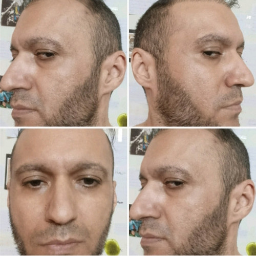 1000052904.jpg