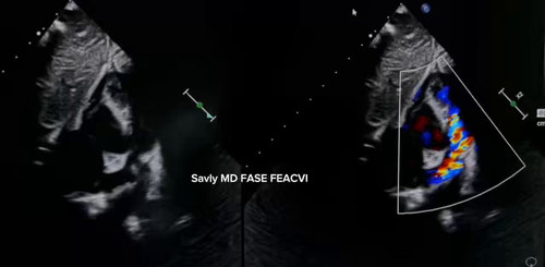 oPEMdV2mynCF NUh.jpg