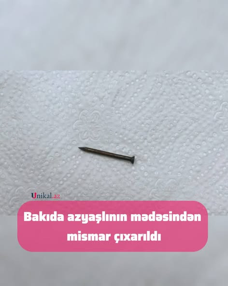 599655636 837769302402341 2908765737226691078 n.jpg?stp=dst jpg s590x590 tt6& nc cat=105&ccb=1 7& nc.jpg