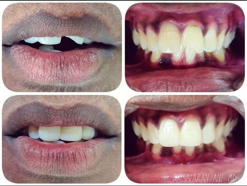 dental 4.jpg