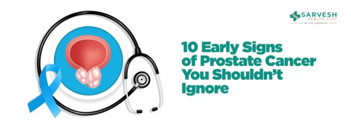 10 early signs of prostate cancer you shouldnt ignore 768x288.png