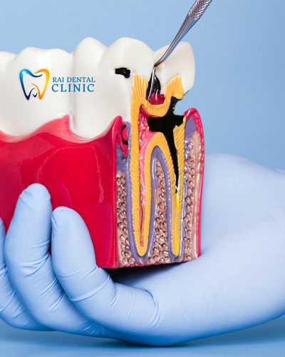 Good Dentist in Bhopal for Reliable and Gentle Dental Care.png
