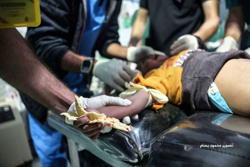 ظل متمسكًا بلقمة الخبز في المستشفى.. لحظة نقل طفل مصاب بقصف الاحتلال على قطاع غزة...