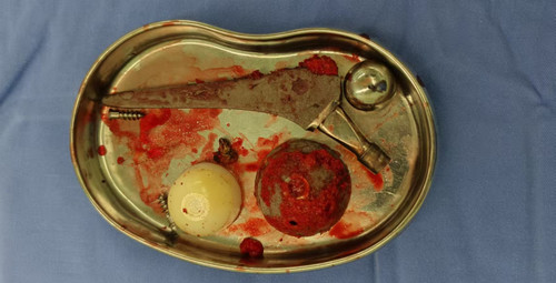 IMG 20251119 220411.jpg